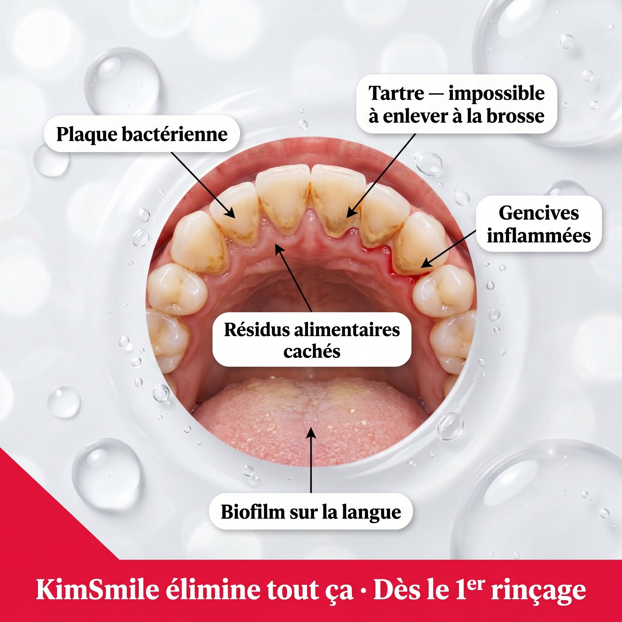Ce que ta brosse à dents laisse chaque soir, KimSmile te le montre. Dès le 1er rinçage.